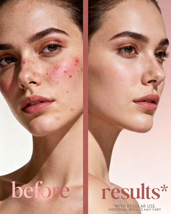 Mint Exfoliating Facial Polish Hydrates All Skin Types Glow